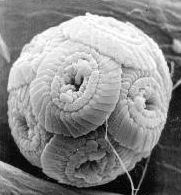 Coccolith under microscope