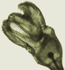 High magnification picture of a pedicellaria